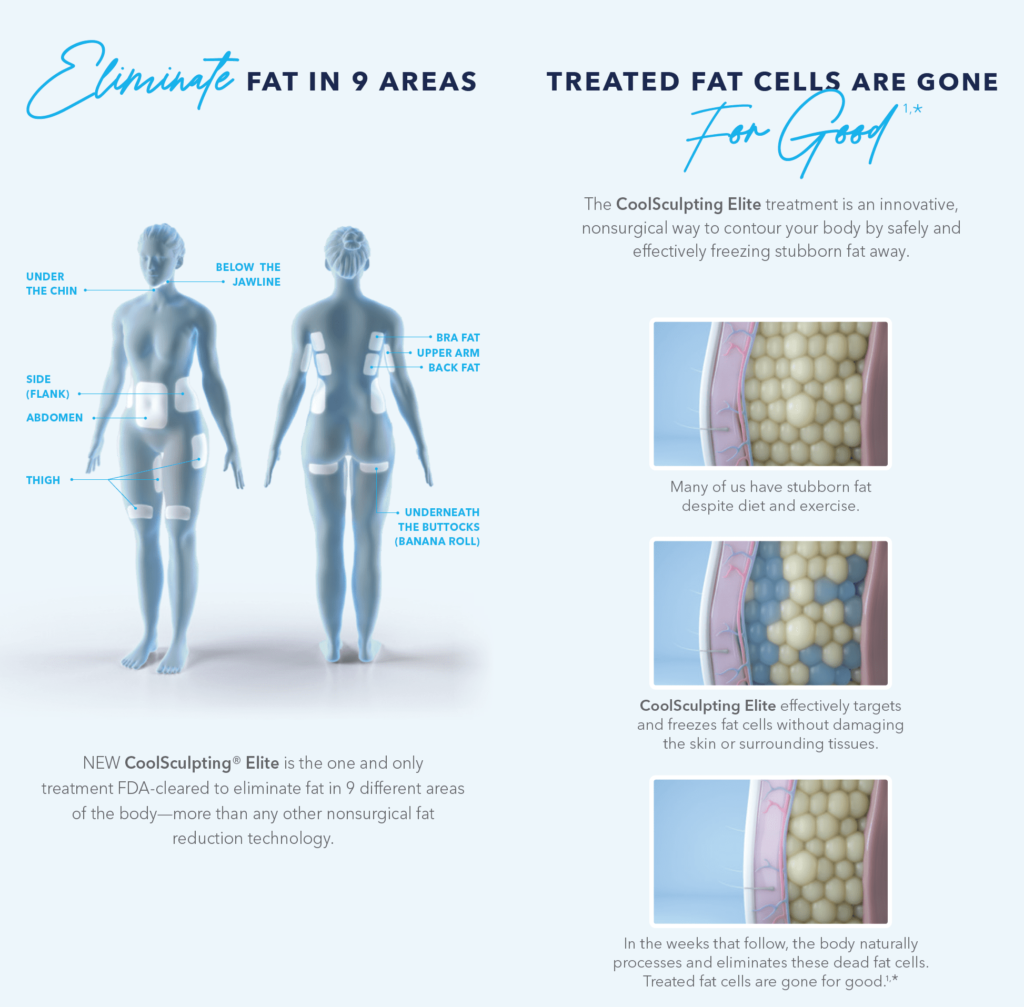 11 Areas of Your Body Coolsculpting Can Improve - The Laser Cafe
